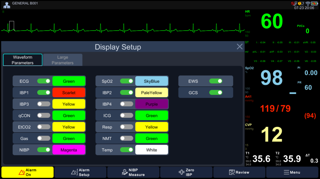 Display Setup — Waveform Parameters Customization Brio X70 Display Setup menu showing Waveform Parameters customization with individual toggle controls and color coding for ECG (Green), SpO2 (SkyBlue), IBP1 (Scarlet), IBP2 (PaleYellow), NIBP (Magenta), Temp (White), with EWS and GCS early warning scoring enabled
