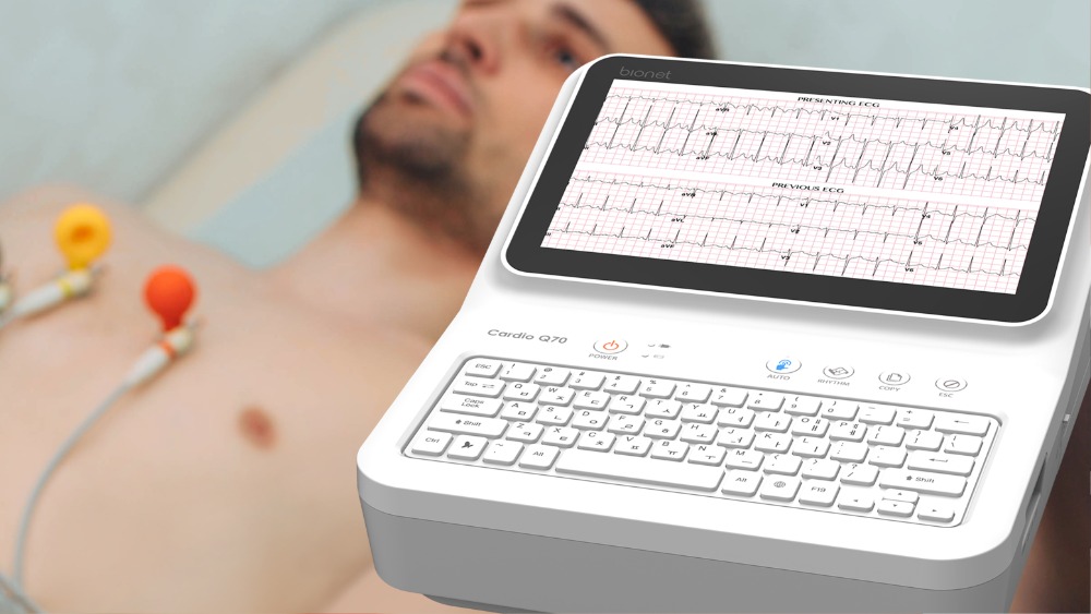 cardio-q70-resting-ecg-in-clinical-use Cardio Q70 resting ECG device in clinical use with patient electrodes attached, displaying presenting and previous ECG comparison