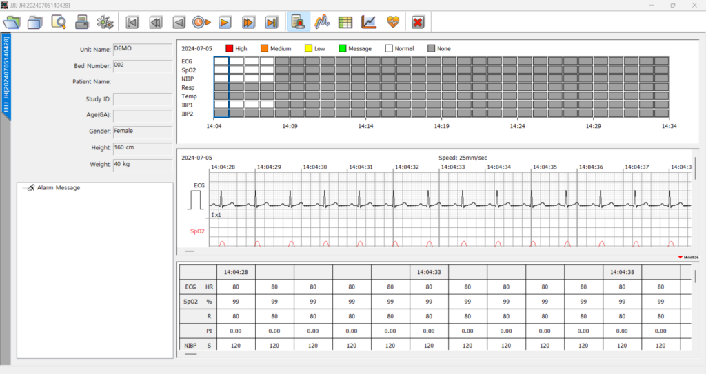 bm-central-pro-bmreview-patient-data-detail-screen-with-vital-trends BM Central Pro BMReview application patient data detail screen showing alarm flags, ECG strip, SpO2 strip, and tabular vital sign trends with timestamps