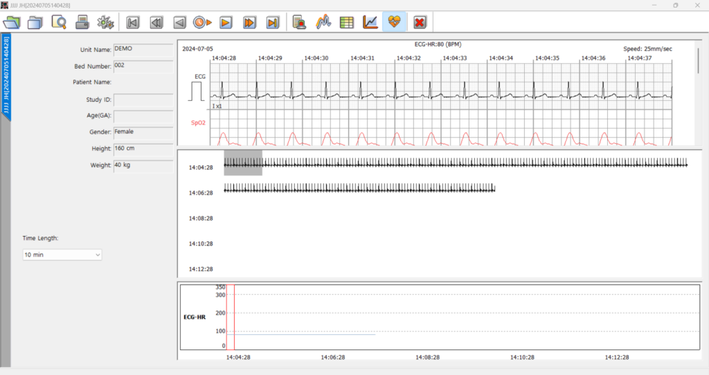 bm-central-pro-bmreview-extended-ecg-strip-multi-zoom-view BM Central Pro BMReview extended ECG strip view with multi-resolution zoom and HR trend graph for arrhythmia retrospective analysis