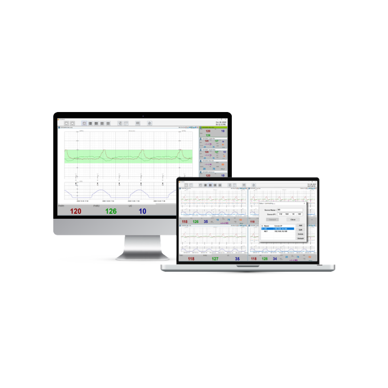 FC Central multi-patient fetal monitoring software shown on desktop monitor and laptop displaying multi-channel fetal heart rate trends with FHR values and patient list interface