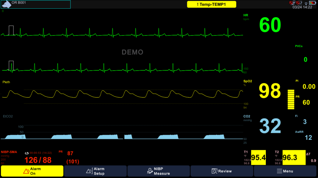 Display — ECG, SpO2 and EtCO2 Capnography Waveforms Brio X7VET display showing ECG, pleth, EtCO2 capnography waveforms with HR 60, SpO2 98, CO2 32 and dual temperature readings for veterinary monitoring