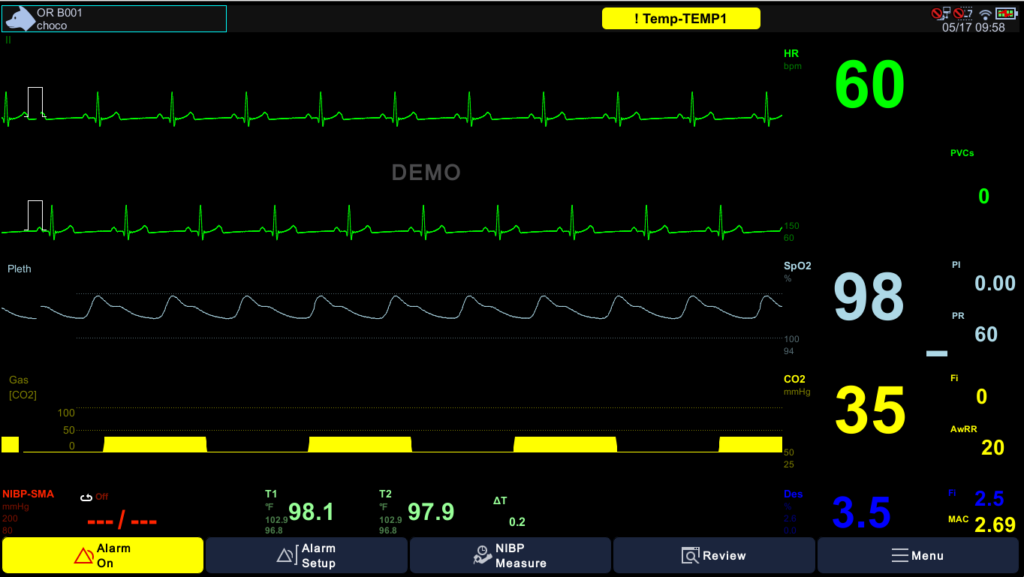 Display — Multi-gas Anesthesia Monitoring with MAC Brio X7VET display with multi-gas anesthesia monitoring showing Desflurane concentration, Fi, MAC value and CO2 capnogram alongside ECG, SpO2 and dual temperatures