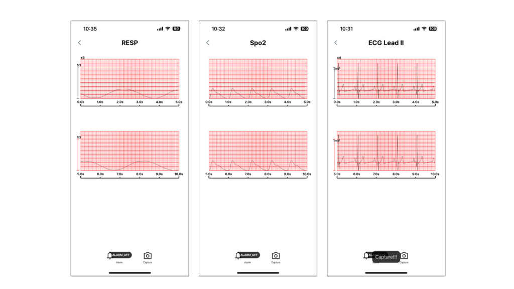 bt-link-next-mobile-app-resp-spo2-ecg-waveform-views BT-Link Next Mobile app waveform view collection — respiration (RESP), SpO2 plethysmograph and ECG Lead II full screen displays for veterinary monitoring