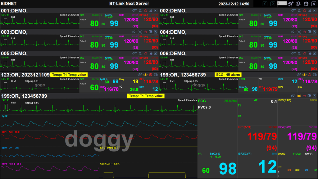 bt-link-next-veterinary-central-monitoring-server-multi-bed-with-detailed-waveform-review BT-Link Next Server multi-bed monitoring with detailed real-time waveform and parameter review including ECG, IBP, SpO2 and respiration trends from a Bionet veterinary patient monitor