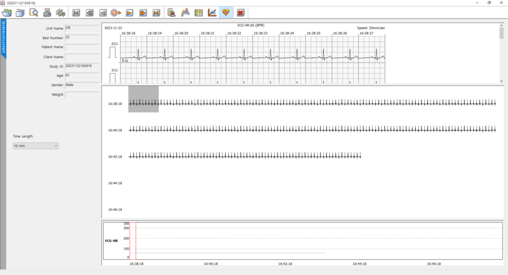 bt-link-next-recorded-data-ecg-long-term-trend-review BT-Link Next recorded data review with long-term ECG trend (10-minute compressed view) and real-time ECG waveform for retrospective rhythm analysis of veterinary patients