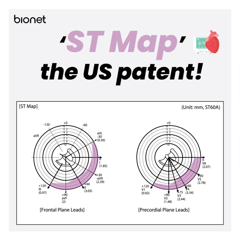 ST-Map-SNS.jpg