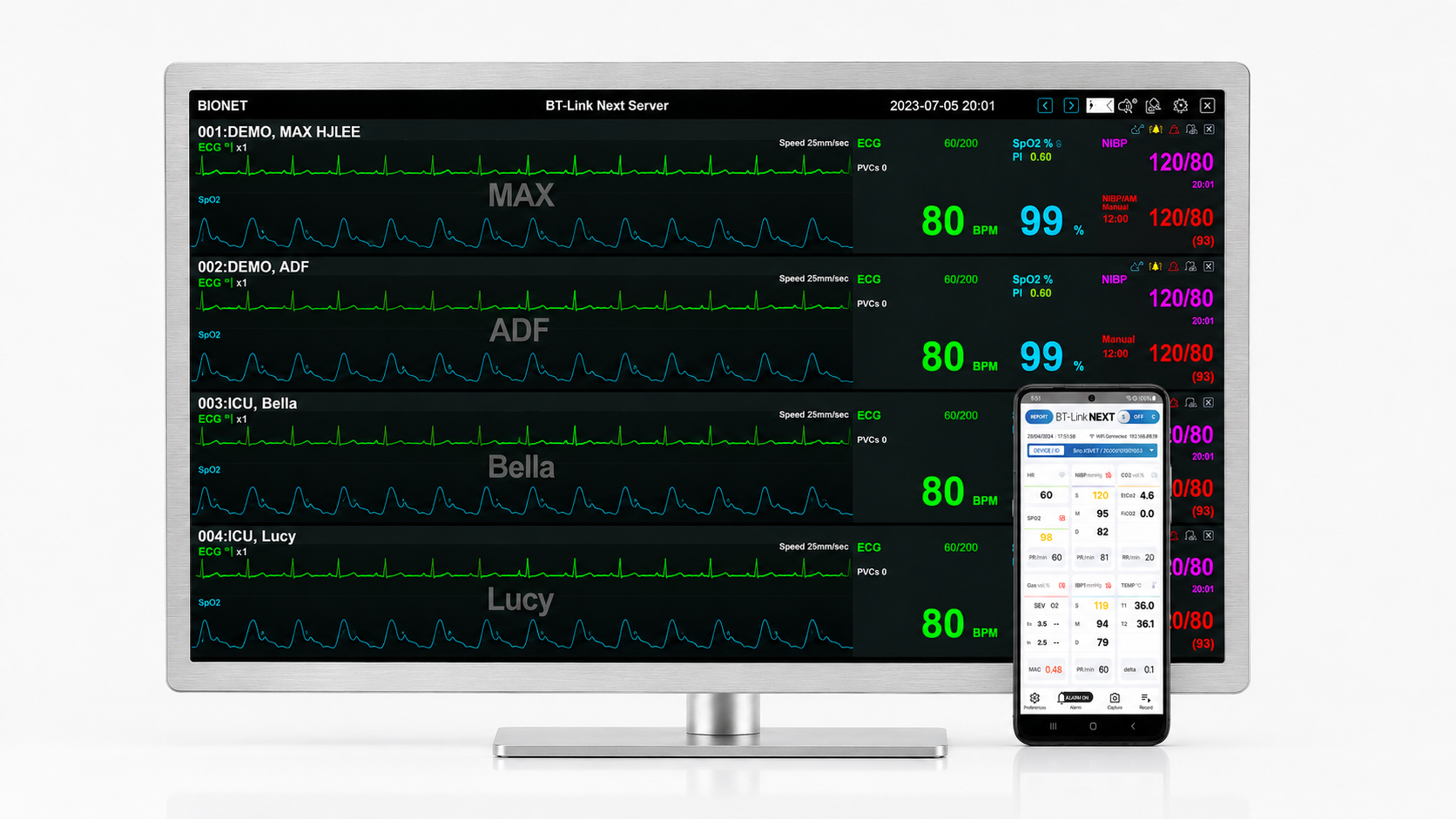 BT-Link Next Server | Central Patient Monitoring System with Mobile Remote Monitoring BT-Link Next Server central patient monitoring system with mobile application displaying real-time ECG, SpO₂, NIBP, and vital signs for remote multi-patient monitoring in hospitals and veterinary clinics.