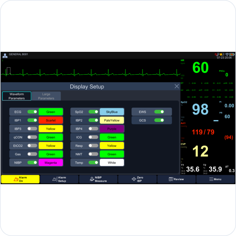 Bionet Brio X30 patient monitor — intuitive capacitive touchscreen for precise caregiving workflow (design sample)