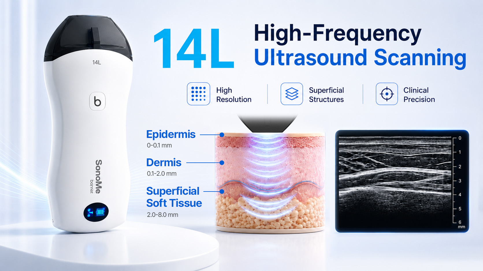 BIONET SonoMe 14L High-Frequency Wireless Ultrasound BIONET SonoMe 14L high-frequency wireless ultrasound probe for high-resolution imaging of superficial structures and soft tissue.