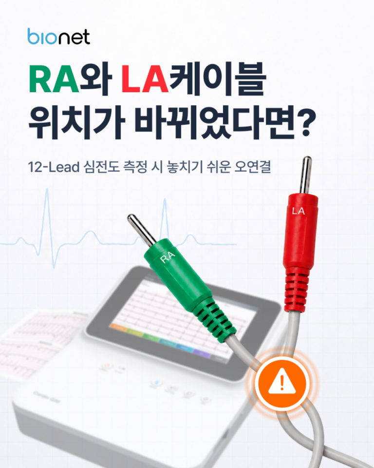 심전도 검사 전 꼭 확인하세요!