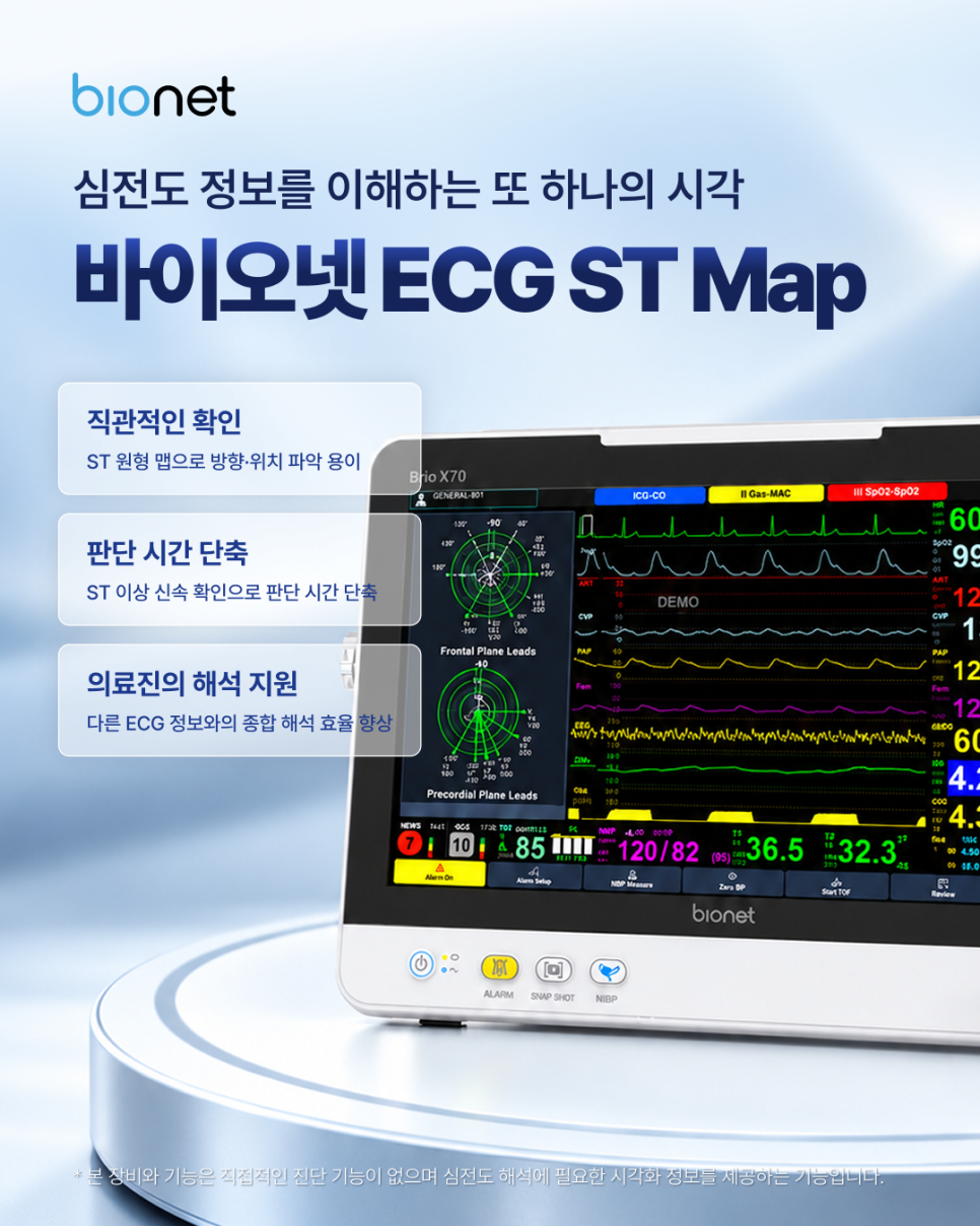 환자감시장치의 ST Map으로 살펴보는 심전도 ST 구간 변화