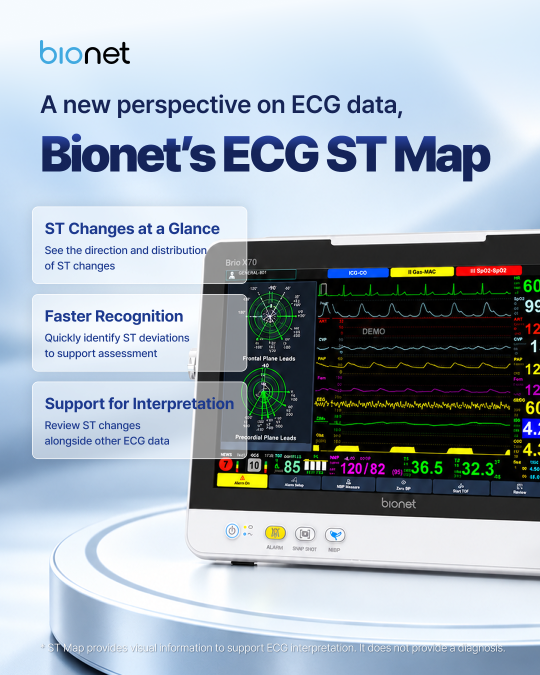 Bionet ECG ST Map on the Brio X70 patient monitor: ST changes at a glance, faster recognition, and support for interpretation.