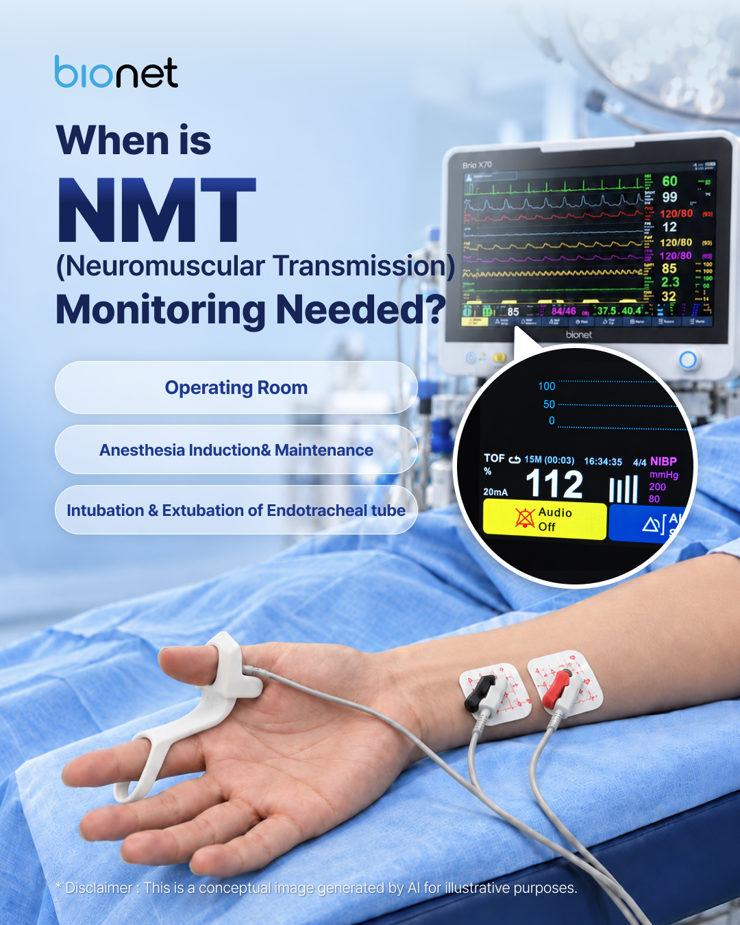 When NMT monitoring is needed: operating room, anesthesia induction and maintenance, and intubation and extubation of the endotracheal tube.