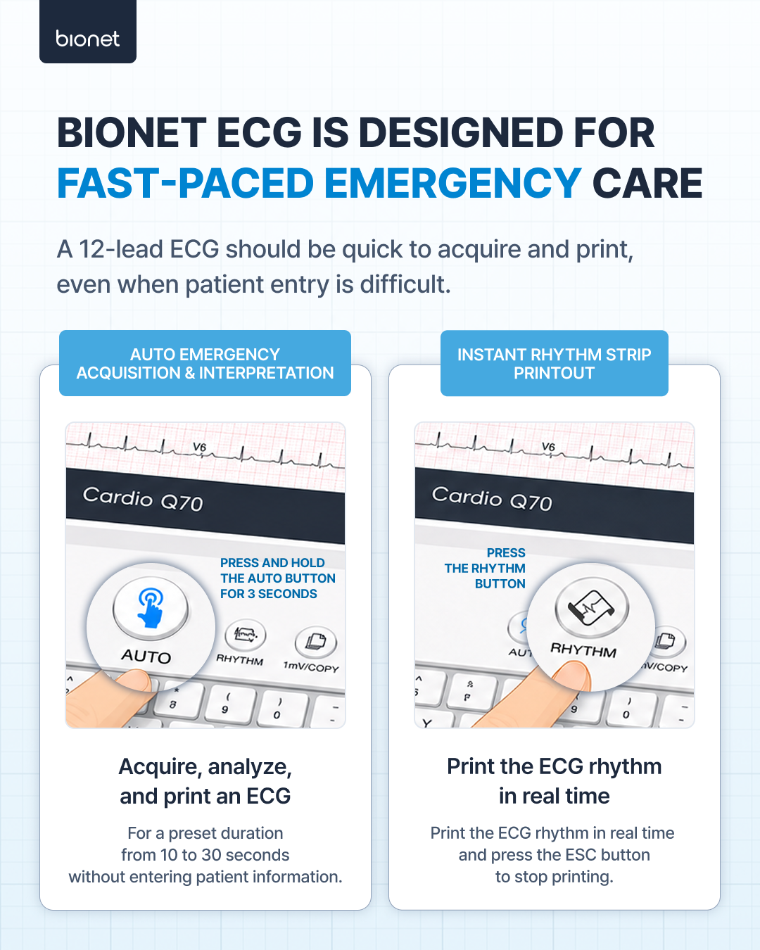 Bionet ECG for fast-paced emergency care: hold the AUTO button for three seconds to acquire and print, or press RHYTHM for a real-time rhythm strip.