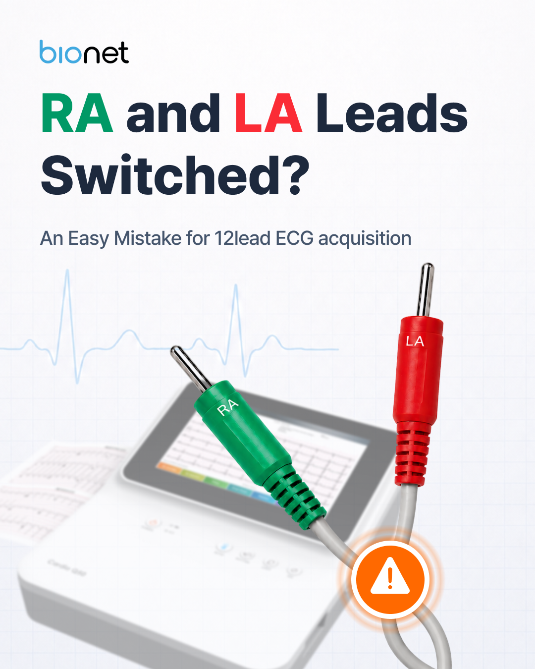 RA and LA leads switched — an easy mistake during 12-lead ECG acquisition, shown with green RA and red LA connectors.