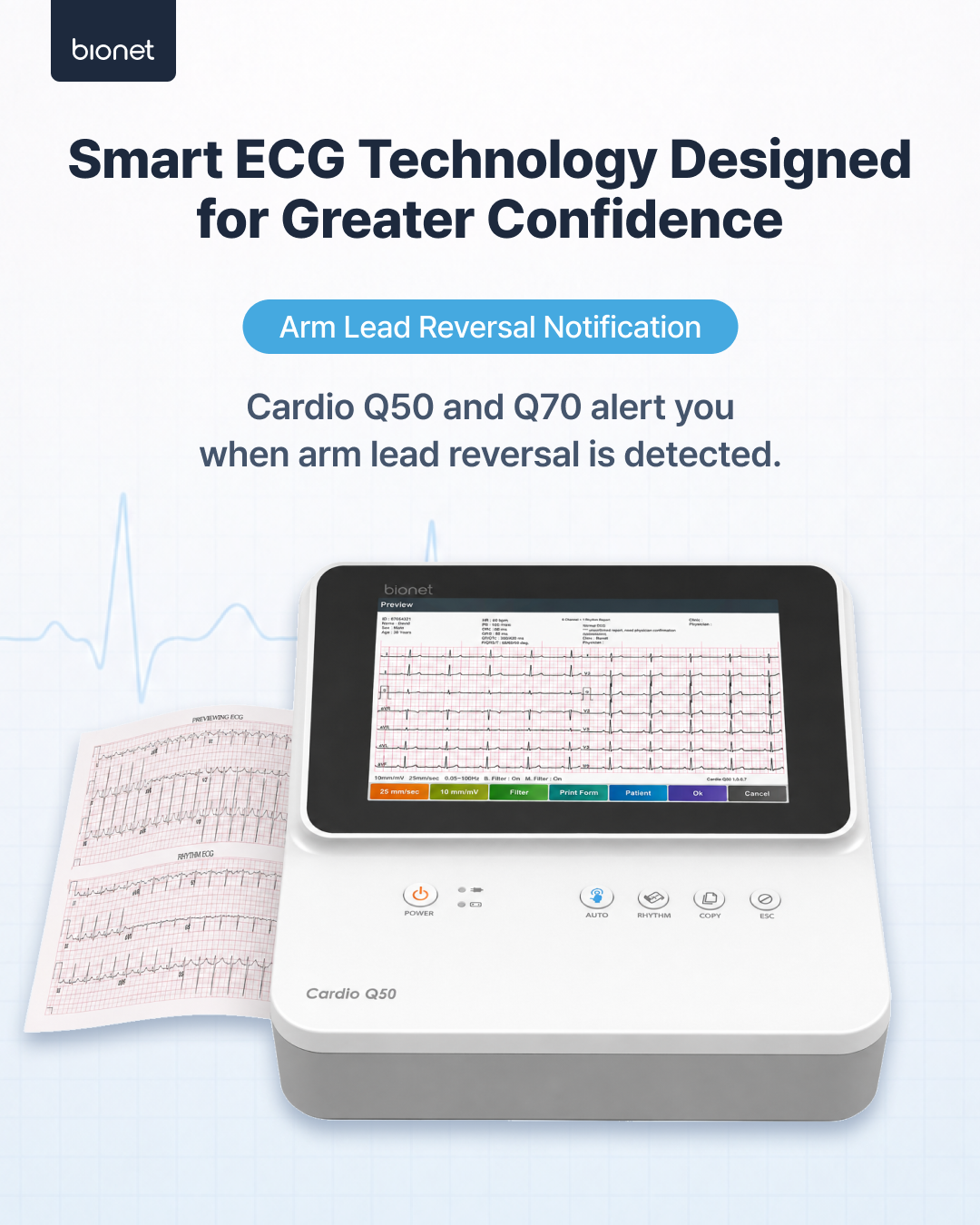 Arm Lead Reversal Notification: the Bionet Cardio Q50 and Q70 alert the user when arm lead reversal is detected.